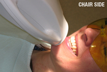 Tooth Whitening