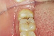 Oral Surgery