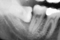 Oral Surgery
